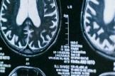 close up of brain MRI